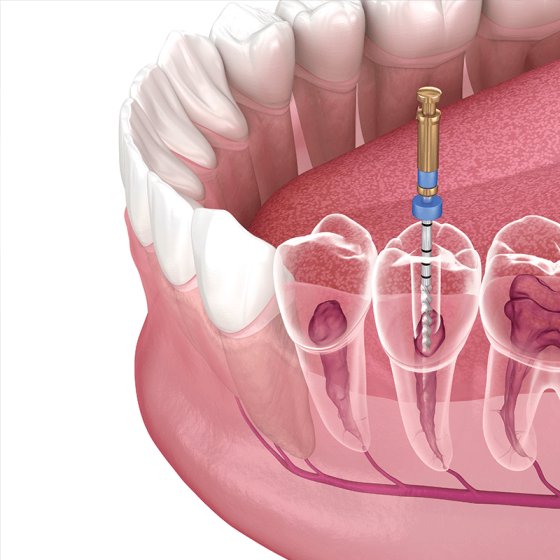 Complete Dental Care