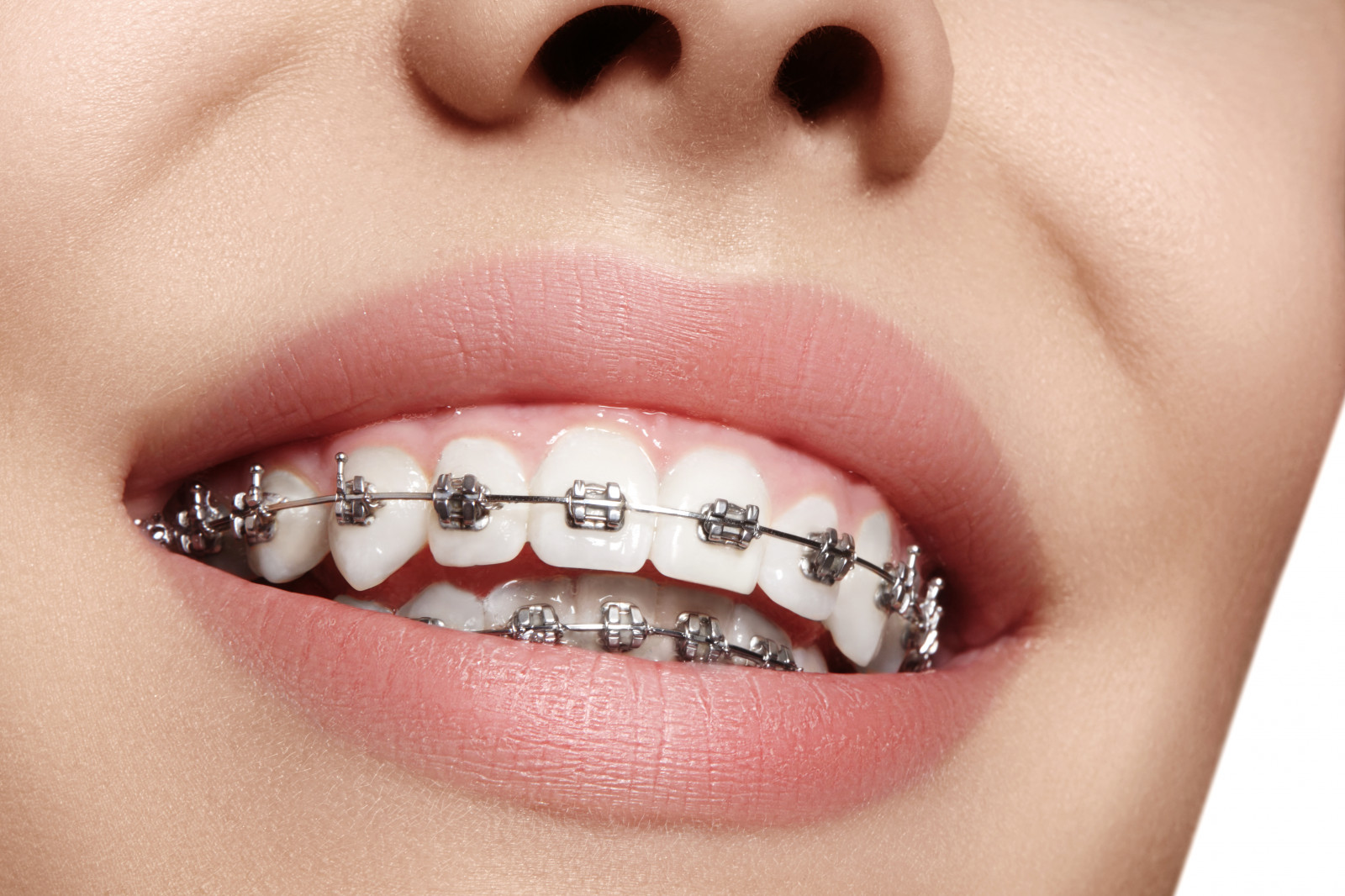 Complete Dental Care