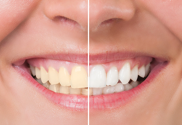 Complete Dental Care