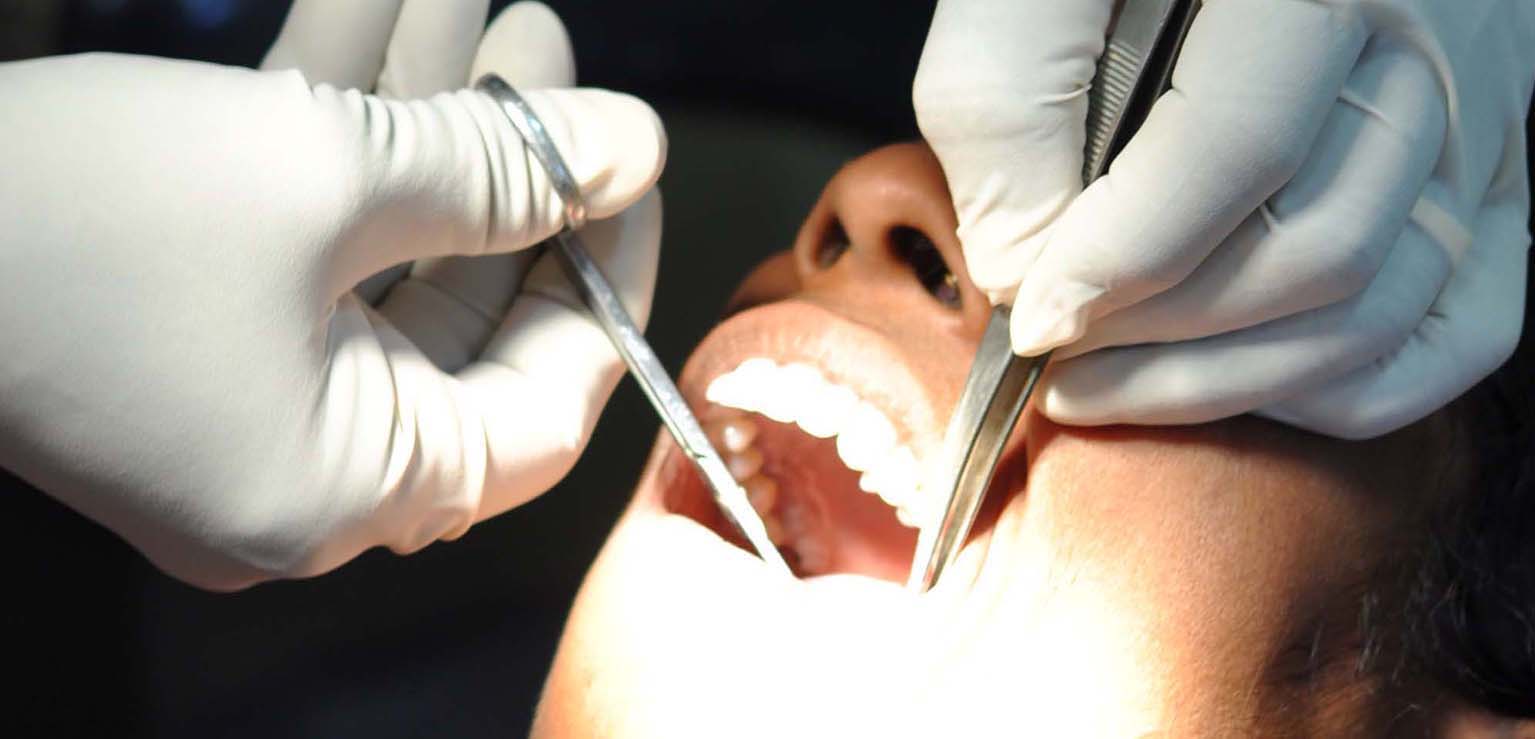 Complete Dental Care