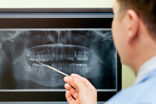 Complete Dental Care